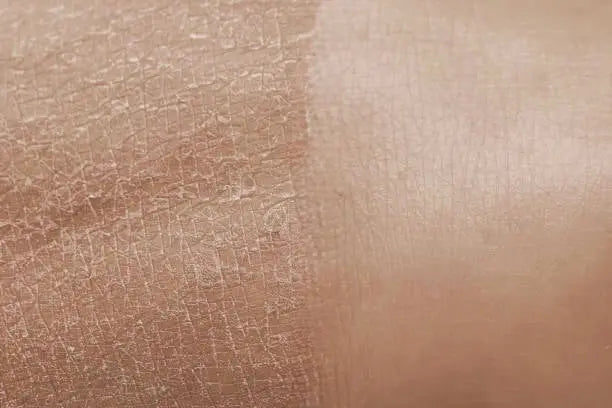 Huile Nutri'Eclat-Hydratation intense