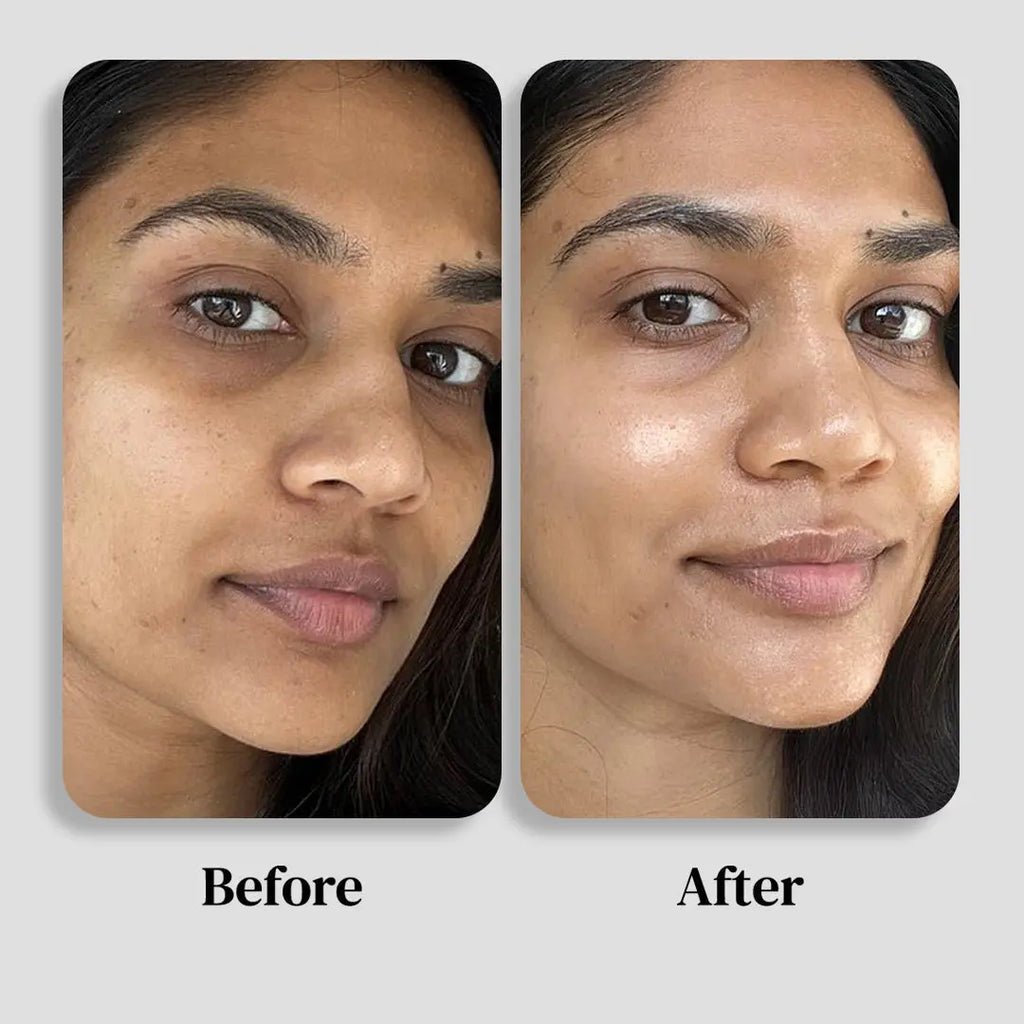 Box anti-tâches brunes Selfnamed