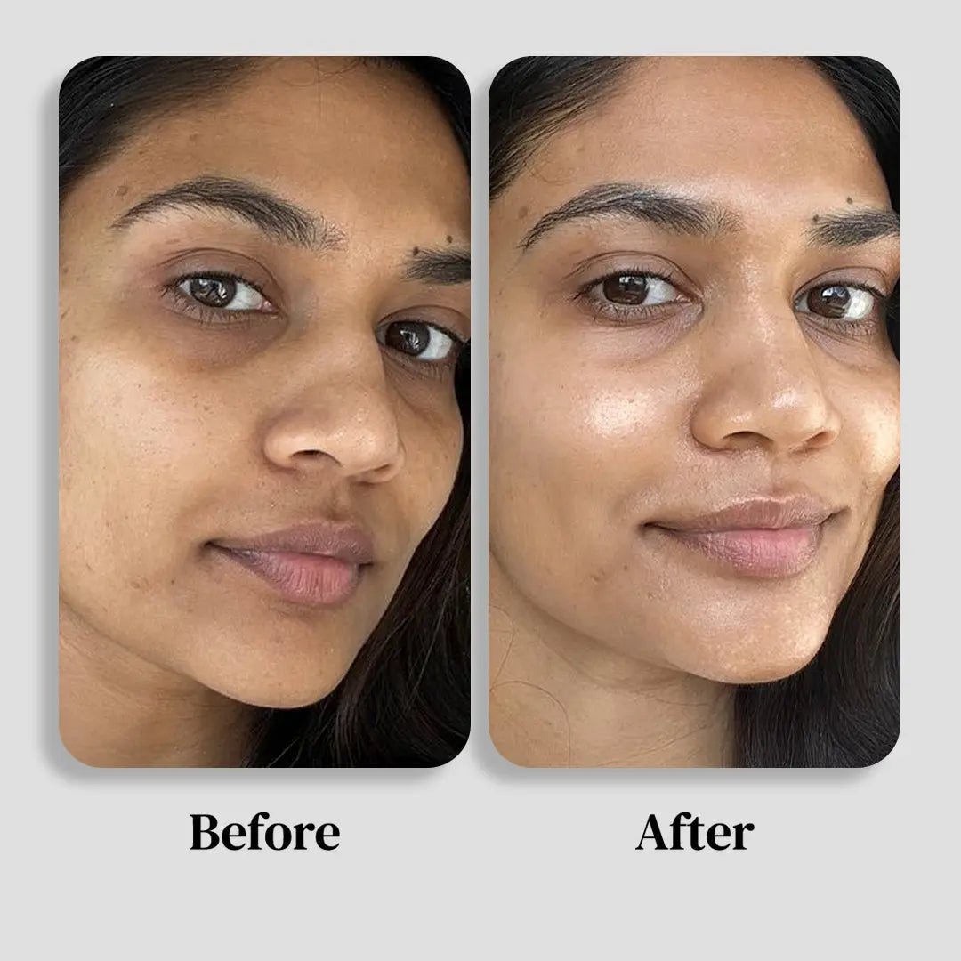 Box anti - tâches brunes - S.BOTANICA