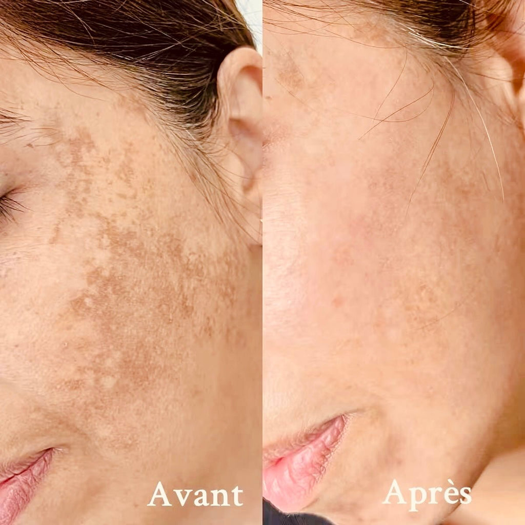 Vitamine C + Sérum - S.BOTANICA