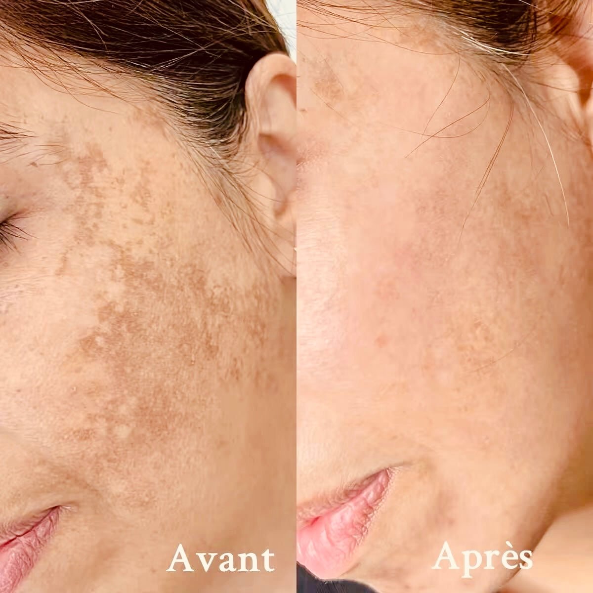 Vitamine C + Sérum - S.BOTANICA